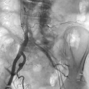 JZ12 DRF移动式平板C形臂(DSA)数字影像系统